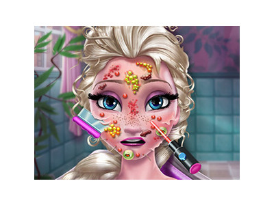 엘사의 얼굴 치료사 게임 ▶ ICE QUEEN SKIN DOCTOR