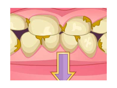 나쁜 치아 치료와 화장하기 게임 ▶ BAD TEETH MAKEOVER